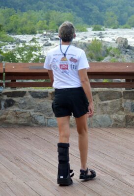 2015 VA Great Falls NP: torn tendon acting up